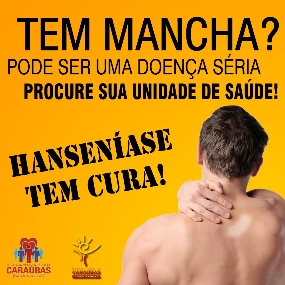 Campanha de combate a Hanseníase e Tuberculose inicia em Caraúbas